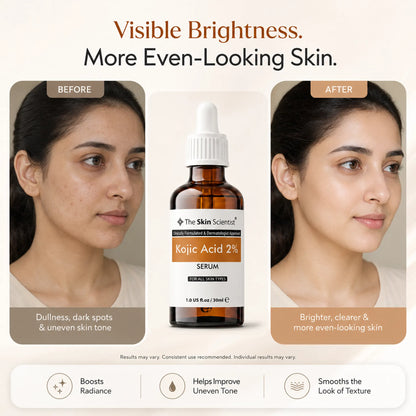 2% Kojic Acid Serum