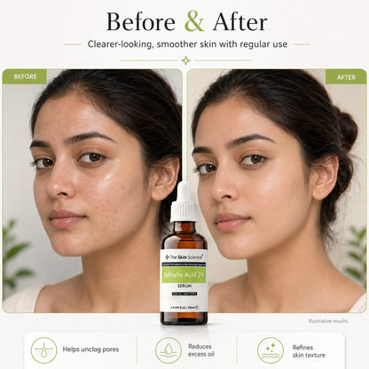 Salicylic Acid Serum