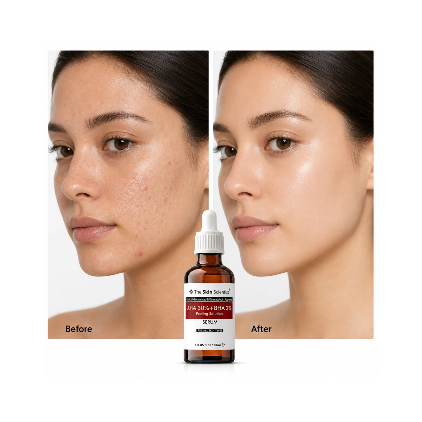 30% AHA Serum & 2% BHA (Peeling Solution)