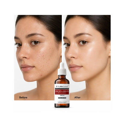 30% AHA Serum & 2% BHA (Peeling Solution)