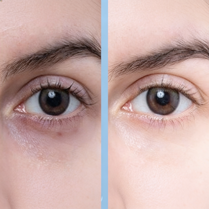 Eye Roller