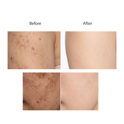 Kojic Acid Soap
