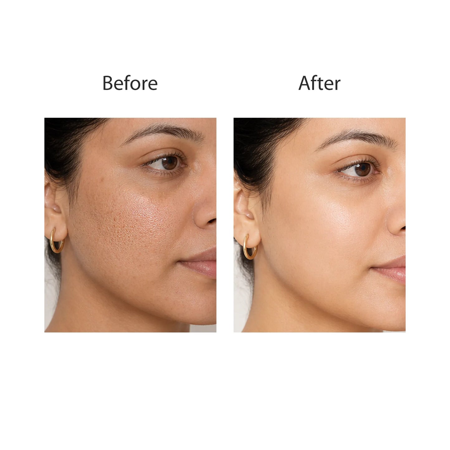 Glycolic Acid 7% - Toning Solution
