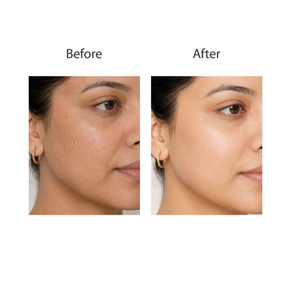 Glycolic Acid 7% - Toning Solution